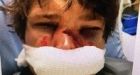 'He only got 30 days for breaking someone�s face'; Goalie who destroyed hockey p