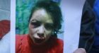 Three held over beating of Ukraine activist Chornovol
